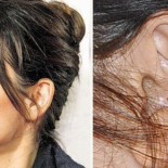 Alerta magufo: auriculoterapia, o vudú 2.0