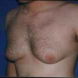 Alarma en el ejército alemán por la aparición de tetas en los soldados de un batallón de élite