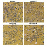 Científicos identifican una proteína que bloquea el VIH, Ébola y otros virus patógenos (eng)