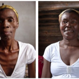 Duro timelapse de una enferma de SIDA