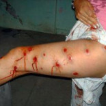 Colombia: los antidisturbios mutilan a decenas de personas durante una huelga en el sector cafetero