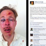 Brutal paliza homófoba en París