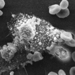 Ataque nuclear al cáncer en su núcleo y sin efectos colaterales