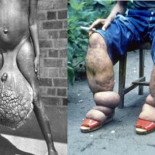 10 parásitos con extrañas aficiones (no aptas para sensibles)