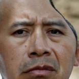 Lo indemnizan con 58 millones de dólares tras dejarle sin parte de su cabeza