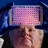 Las superbacterias amenazan a España