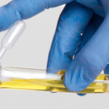 Identifican todo tipo de células madre en la orina humana