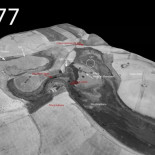 El agua aflora en los Ojos del Guadiana y alguien lo tapa con tierra y piedras
