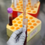 Identificadas 20 causas genéticas de los cánceres más comunes