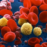 Buenas perspectivas contra el cáncer de próstata