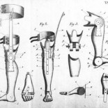 Hola, soy tu cerebro y quiero que te amputes la pierna