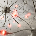 ¿A qué suena un ataque cerebral?