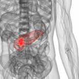 Hallan la mutación genética que hace que algunas personas nazcan sin páncreas