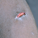 Mariano Rajoy: "No sé si las cuchillas pueden producir efectos sobre las personas"