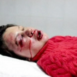 Brutalmente agredida en Ucrania la periodista de investigación Tatiana Chornoból