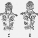 Fidel Pagés Miravé, el olvidado descubridor de la anestesia epidural