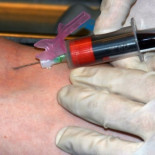 Análisis de sangre sin pinchazos. Adiós a la aguja