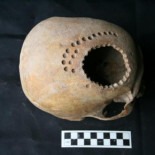 Así eran los ‘neurocirujanos’ de hace 1.000 años