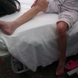 Plataforma por la Dignidad entiende que Clínica Quirón ha incurrido en lo penal por desatender gravemente a una paciente