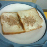 Un hospital público admite que sirvió comida deficiente a una paciente oncológica en Murcia