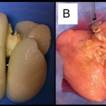 Crean un pulmón humano por primera vez en un laboratorio
