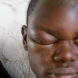 Informes de médicos acreditan lesiones en fallecidos y supervivientes de la tragedia de Ceuta