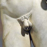 Penes defectuosos, pesticidas y autismo