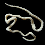 Mi gusano y yo, la historia del parásito que vivió dentro de mi cuerpo