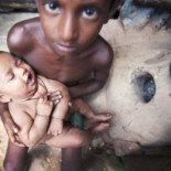 Cómo derrotar a la ameba que devora el intestino de 50 millones de personas