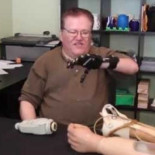 Prótesis de $50 hecha con una impresora 3D comparada con una prótesis mioeléctrica de $42,000