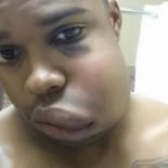 ¿Qué sucede cuando uno es golpeado por una bola de béisbol a 144 km/h?