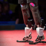 Bailando con una pierna biónica