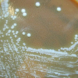 La guerra biológica (I)