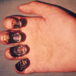 La peste negra mejoró la calidad de vida de los europeos (ING)