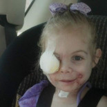 KFC donará 30,000 dólares a la niña que fue expulsada de un local porque su cara daba miedo