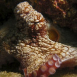 El cerebro más extraño del mundo