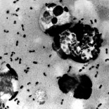 Ciudad china sellada debido a un muerto por peste bubónica[ENG]