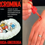 “A mí me echaban mercromina”