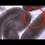 Picadura de medusa grabada con microscopio en alta velocidad