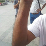 Una seguridad de Bankia muerde a dos activistas de la PAH en Santa Pola