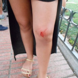 Agresión contra activistas en la concentración Anti-Taurina de San Sebastián de los Reyes