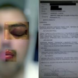 Primera agresión de los nazis que "okuparon" un edificio en Madrid