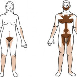 ¿De dónde sale todo ese pelo en el Mediterráneo?