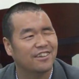 Hombre se recupera después de operación de implante de cráneo impreso en 3D (ENG)