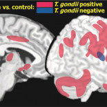 Alteración de la conducta humana por parásitos y el libre albedrío