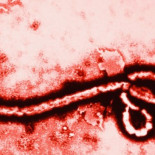 El sorprendente caso de la enfermedad rara que te inmuniza ante el virus del Ébola
