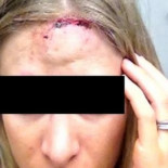 Agresión homófoba a dos adolescentes, una chica lesbiana y un chico gay, en Caravaca de la Cruz (Murcia)