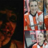 Le desfiguran la cara de una brutal paliza por ser seguidora de River Plate