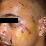 Ordenan el ingreso en prisión de dos policías del caso 4F condenados por torturar a un ciudadano de Trinidad y Tobago