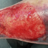 Una mujer de 94 años resulta herida durante la actuación de la Ertzaintza en Gernika